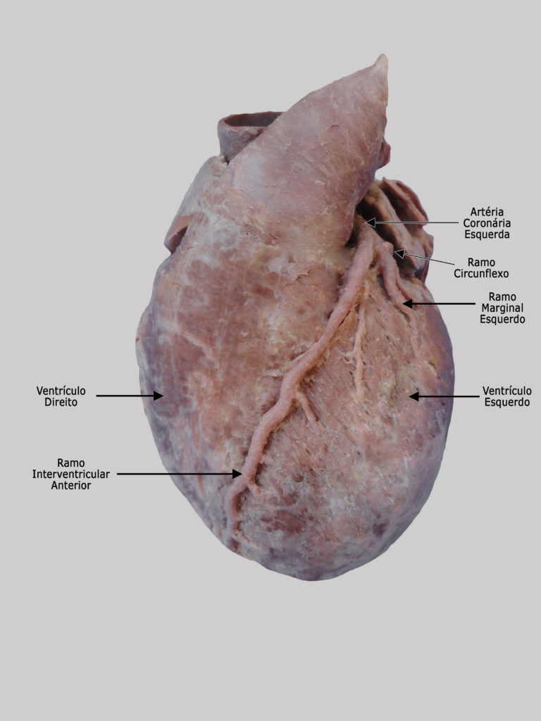 Artéria Coronária Esquerda