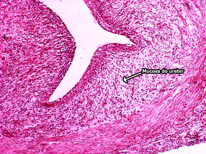 Mucosa do Ureter