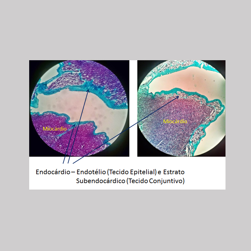 Lâmina Endocárdio