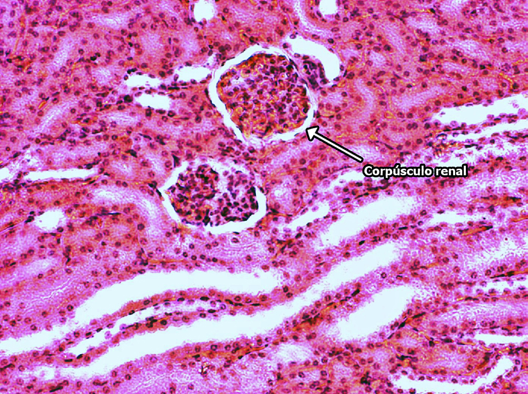 corpúsculo renal